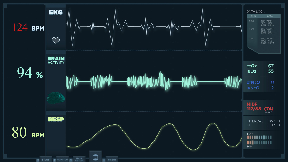 EKG